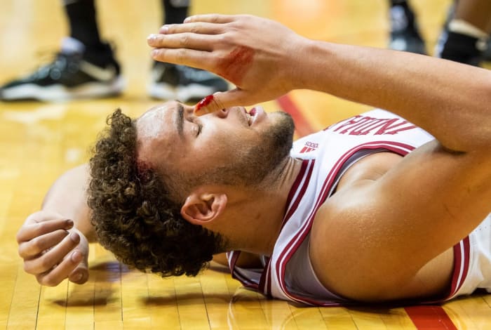 Indiana forward Race Thompson took and elbow to the head that drew blood, but he came back in the game and finished with 20 points. (USA TODAY Sports)